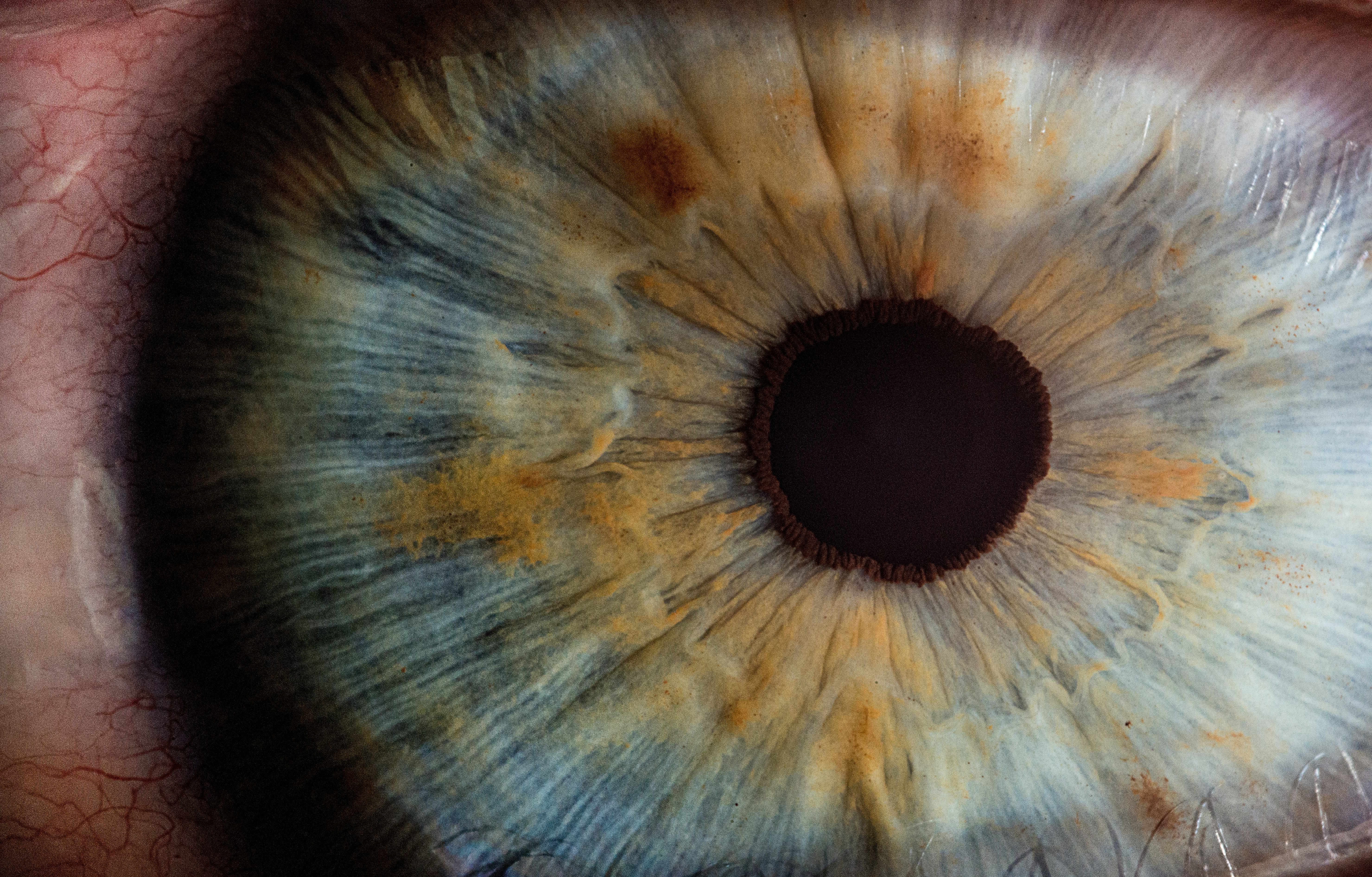 Macular Degeneration: Understanding the Vision Threat